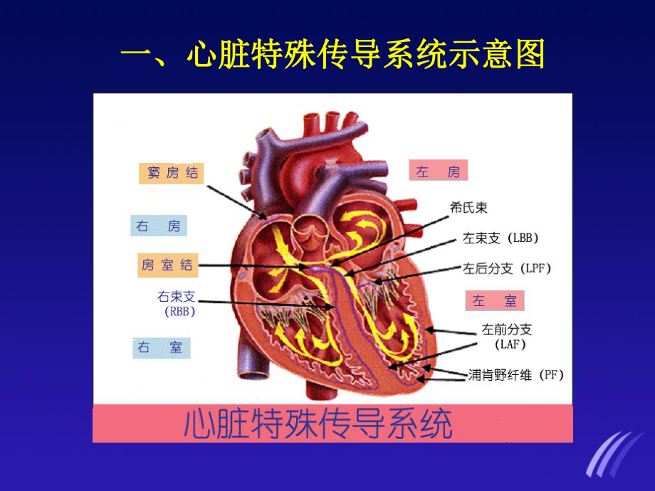 临床常见心电图的判读课件.ppt_第3页