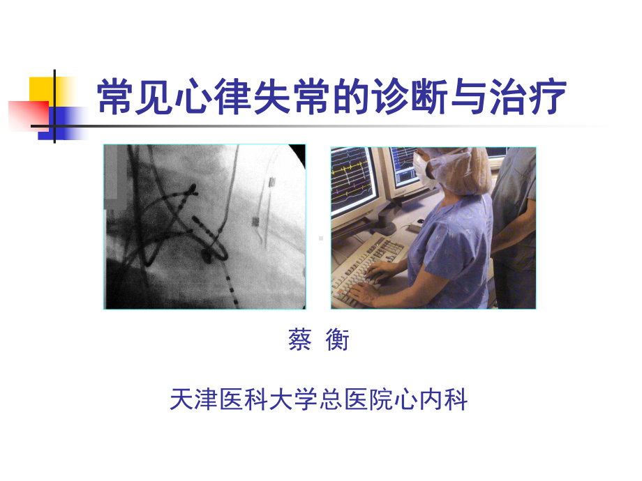 常见心律失常的诊断与治疗课件.ppt_第1页