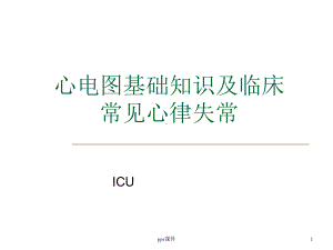 心电图基础知识及临床常见心律失常课件.ppt