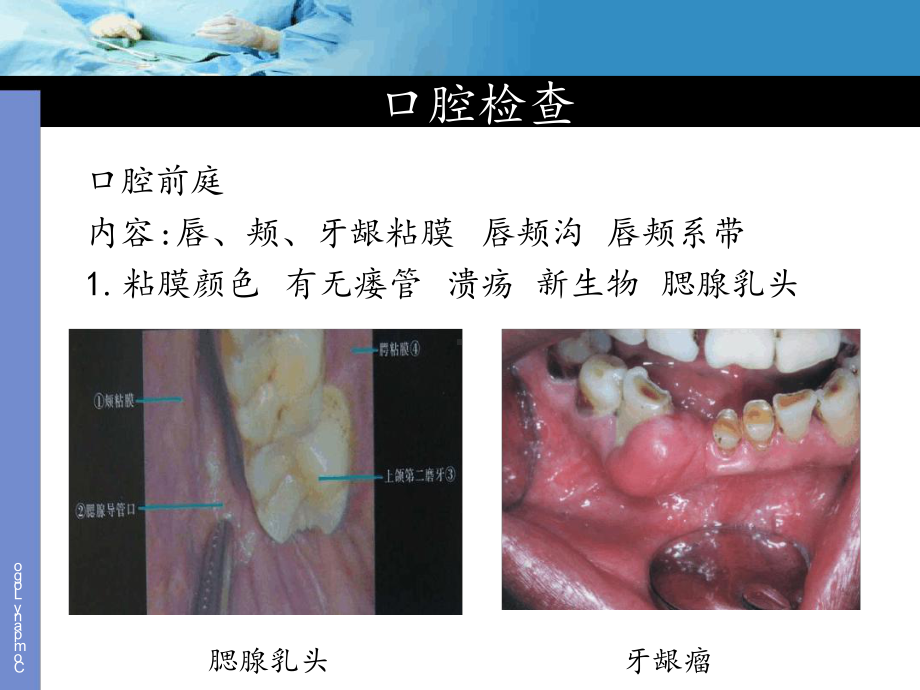 口腔颌面外科临床检查(同名894)课件.ppt_第3页