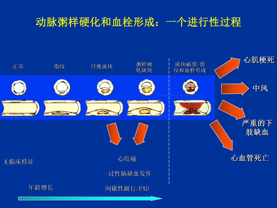 《缺血性脑血管病》课件.ppt_第3页