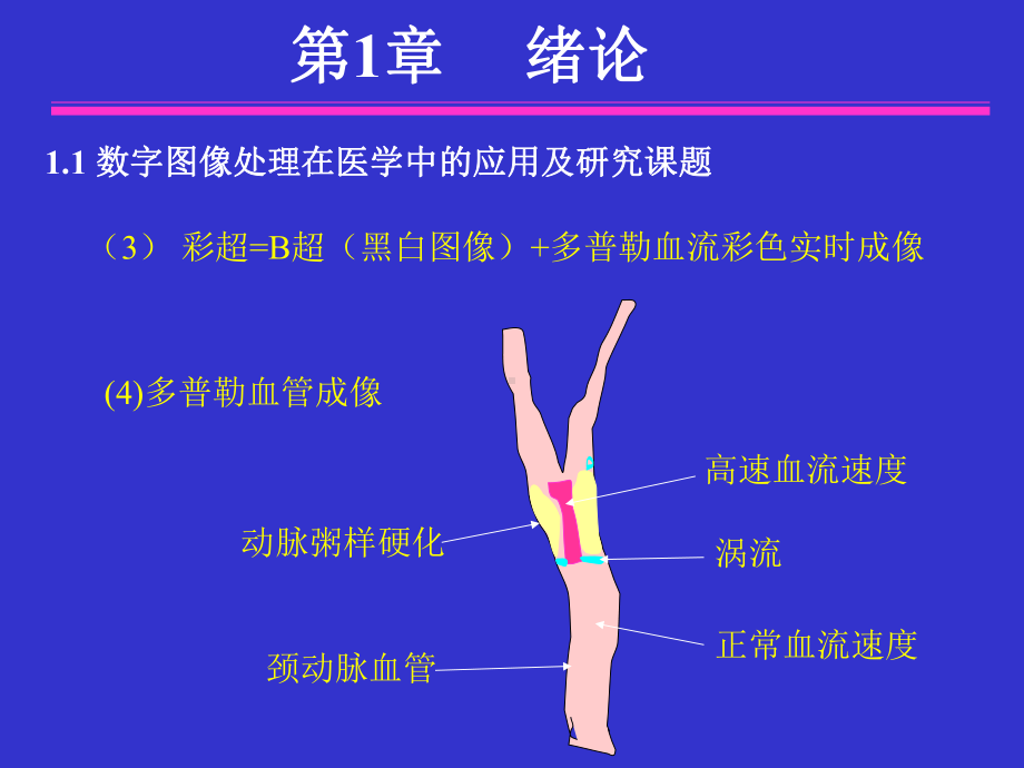 医学图像处理绪论课件.ppt_第3页