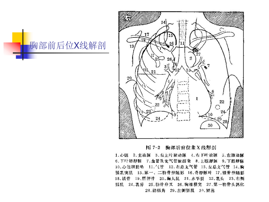 正常胸片胸部CT阅读浅谈课件.ppt_第3页