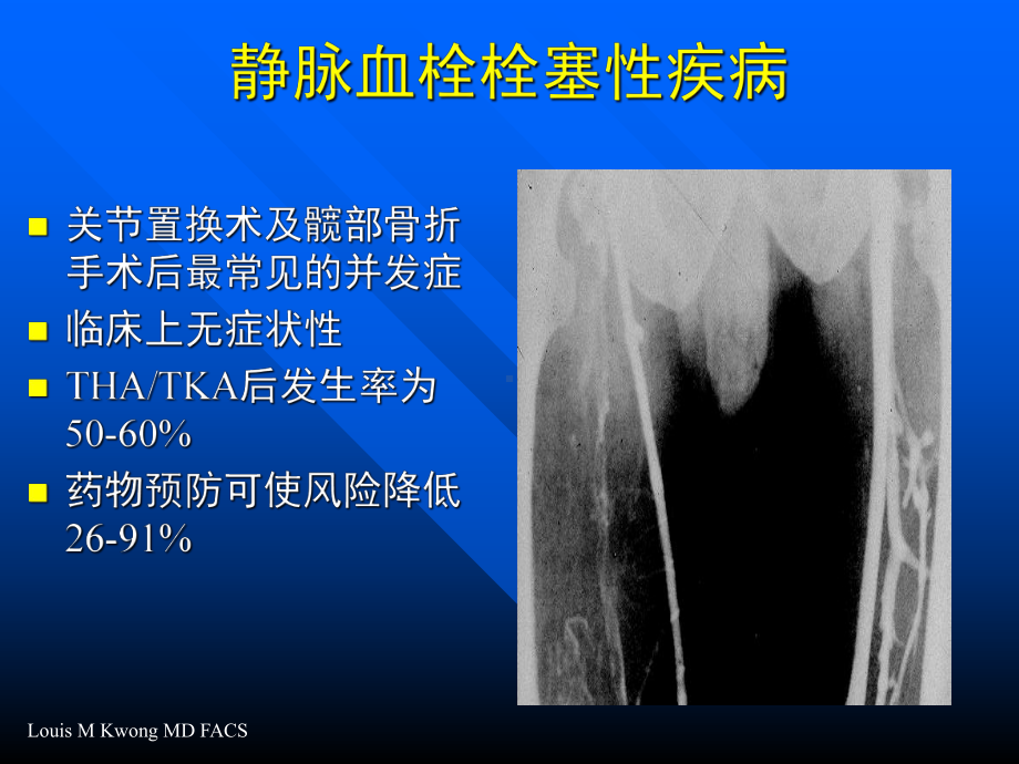 静脉血栓预防中的出血风险课件.ppt_第2页