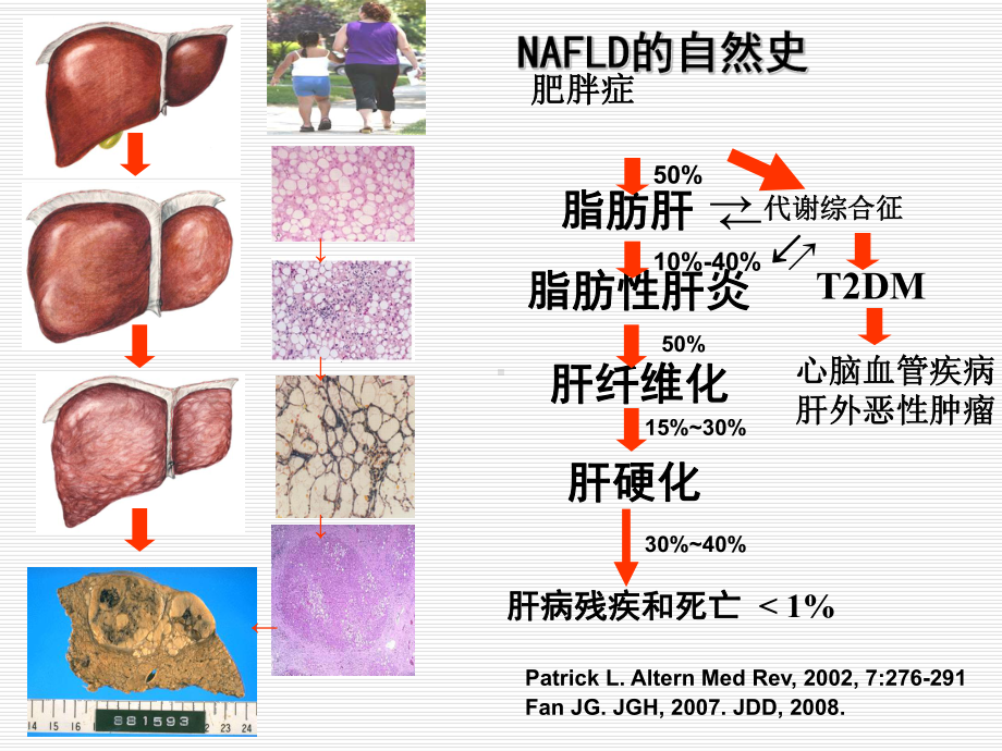 内分泌与肝病课件.ppt_第3页