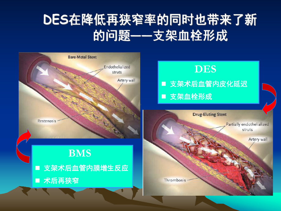 长期双重抗血小板治疗宋治远课件.ppt_第3页