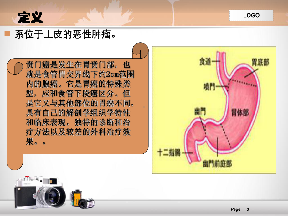 胃癌查房课件.ppt_第3页