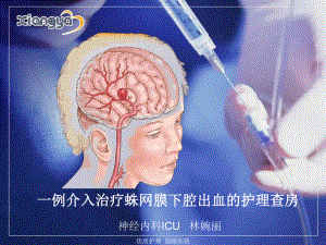 一例介入治疗蛛网膜下腔出血的护理查房(定稿)解读课件.ppt