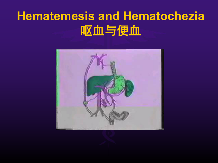 诊断学呕血与便血 英文版课件.ppt_第2页