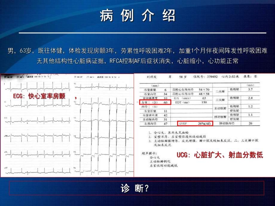 心律失常性心肌病课件.ppt_第2页