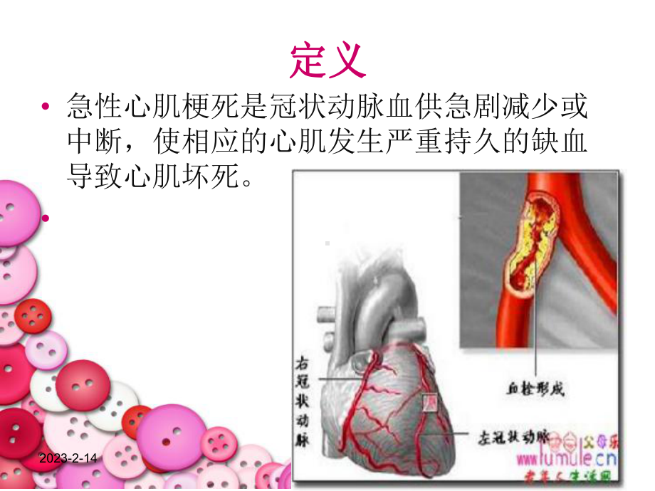 急性心肌梗死病人的护理-课件.ppt_第3页