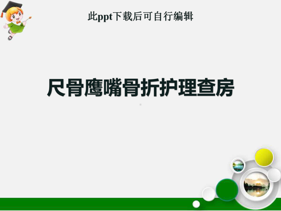 尺骨鹰嘴骨折查房课件.ppt_第1页