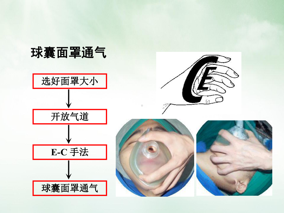 气管插管与气道管理课件.pptx_第2页