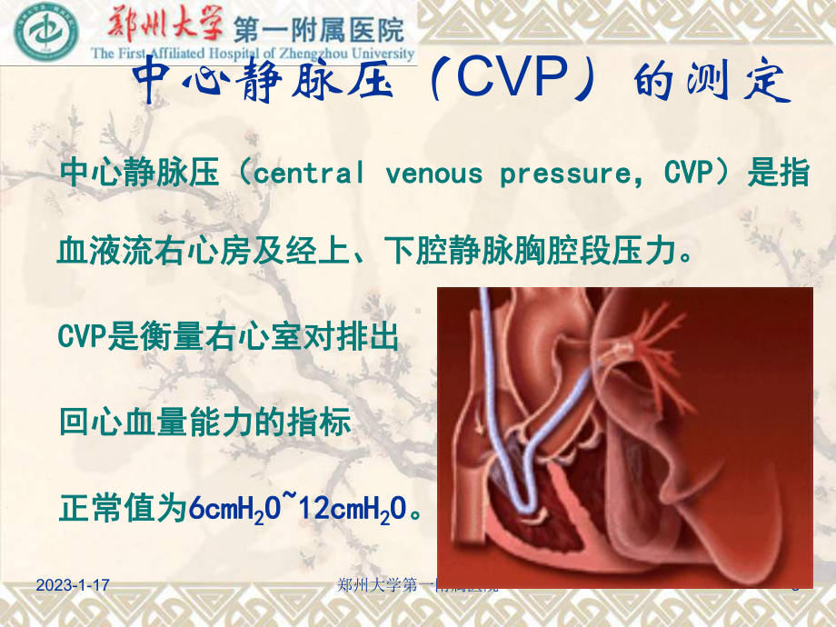 危重患者血流动力学监测技术讲解材料课件.ppt_第3页