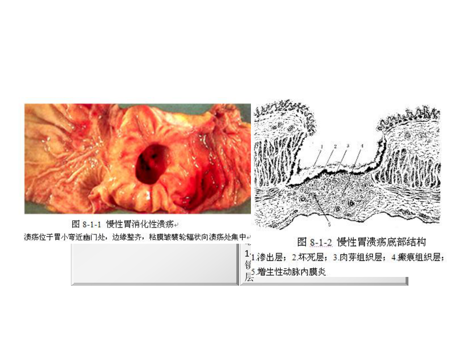 消化系统疾病概述课件.pptx_第3页