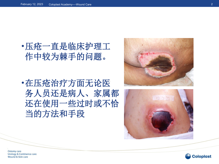 压疮的分级和护理原则课件.ppt_第2页