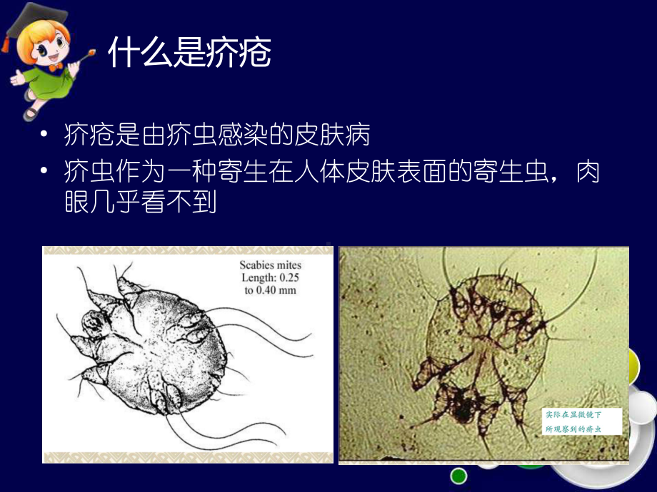 疥疮的预防及治疗课件.ppt_第3页