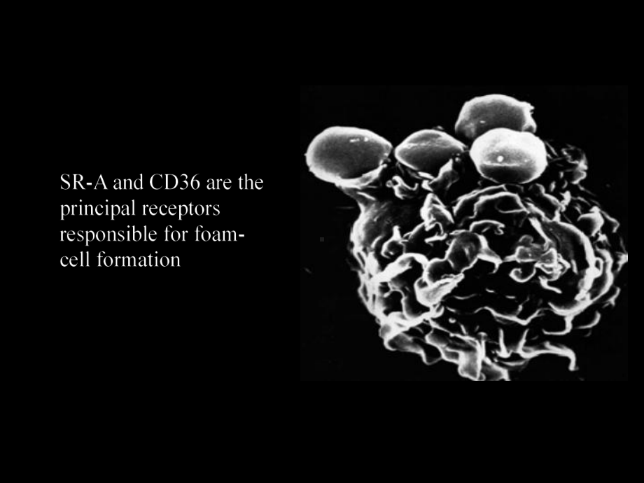 清道夫受体介导的脂质蓄积的分子机制课件.ppt_第3页