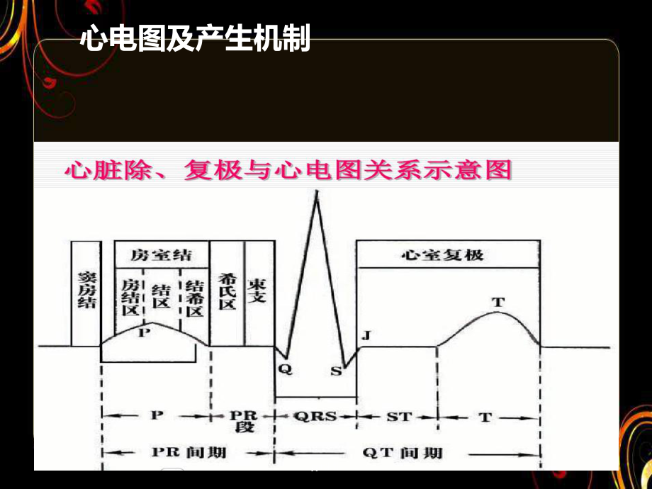 电解质紊乱与心律失常-课件.ppt_第3页