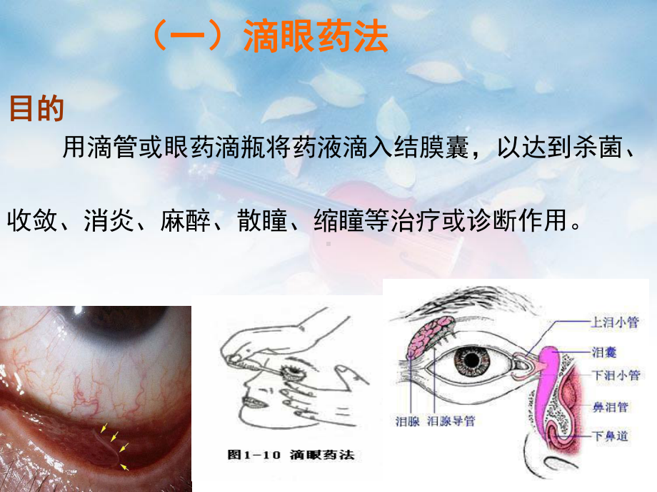 局部给药法解读课件.ppt_第3页