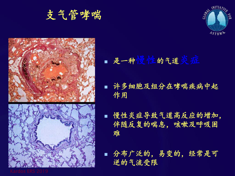 哮喘治疗及吸入装置课件.ppt_第3页