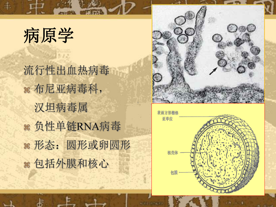 医学流行性出血热课件.ppt_第3页