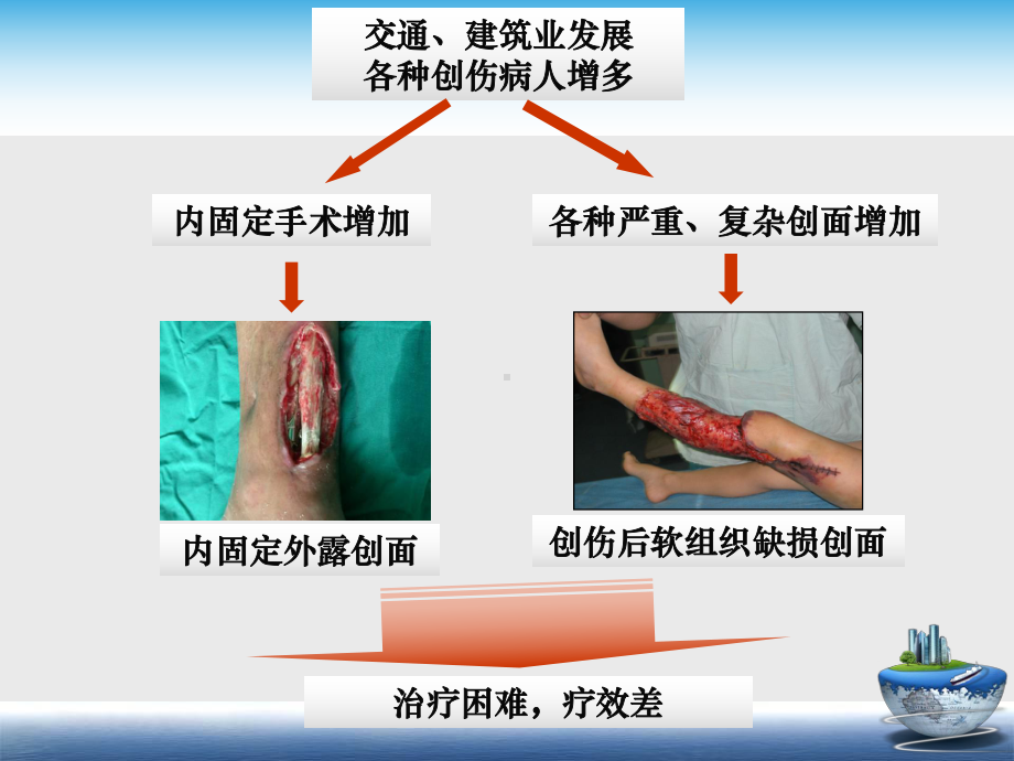 技术的原理示意图医用泡沫材料填充腔隙半透课件.ppt_第2页