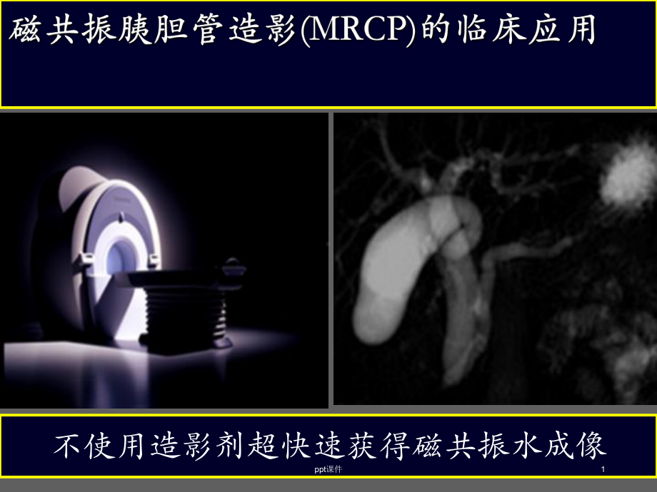 磁共振胰胆管造影(MRCP)的临床应用-课件.ppt_第1页