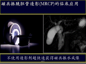 磁共振胰胆管造影(MRCP)的临床应用-课件.ppt