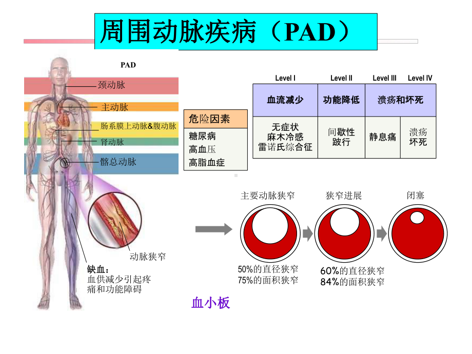 周围动脉疾病PAD-课件.ppt_第3页