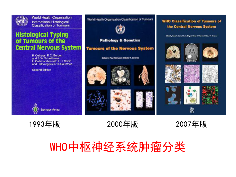 基于分子病理的胶质瘤诊断新变化课件.ppt_第2页