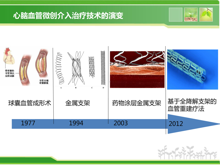 生物可降解血管支架的研究现状综述课件.ppt_第3页