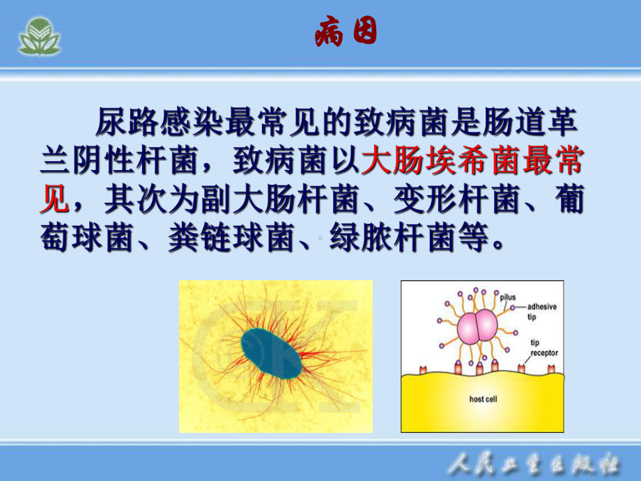 泌尿系感染病人的护理讲解课件.ppt_第3页