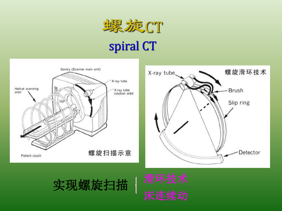 医学影像读片指南-课件.ppt_第3页