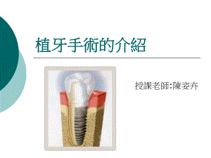 植牙手术的介绍课件.ppt