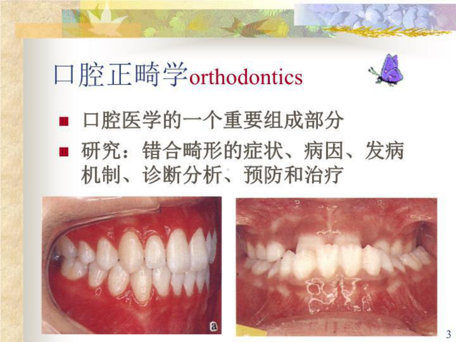 最新口腔正畸学概述课件.ppt_第3页