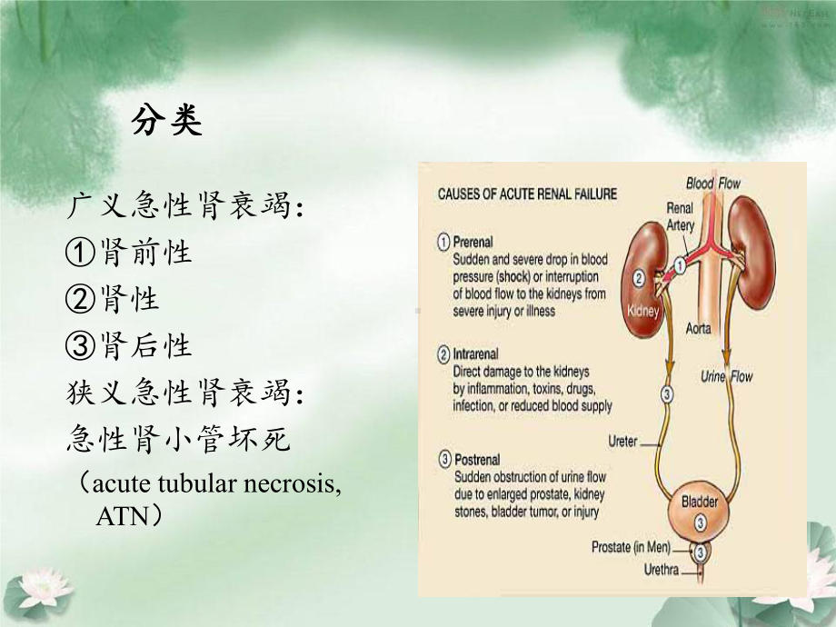 熊燕急性肾衰竭讲义课件.ppt_第3页