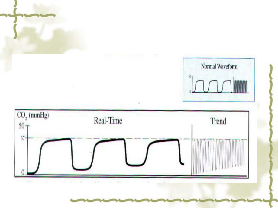 呼末二氧化碳监测解读课件.ppt_第2页