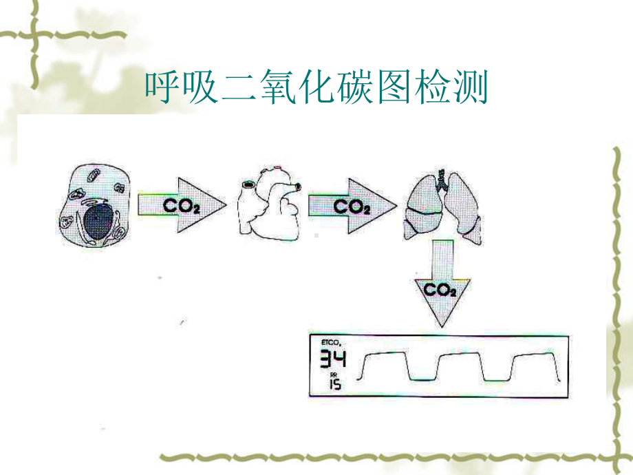 呼末二氧化碳监测解读课件.ppt_第3页