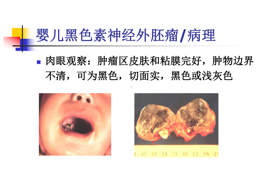 口腔组织病理学-2课件.ppt_第3页