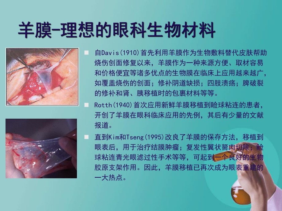 生物羊膜特点与应用-课件.ppt_第2页