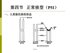 医学遗传学-染色体病课件.ppt