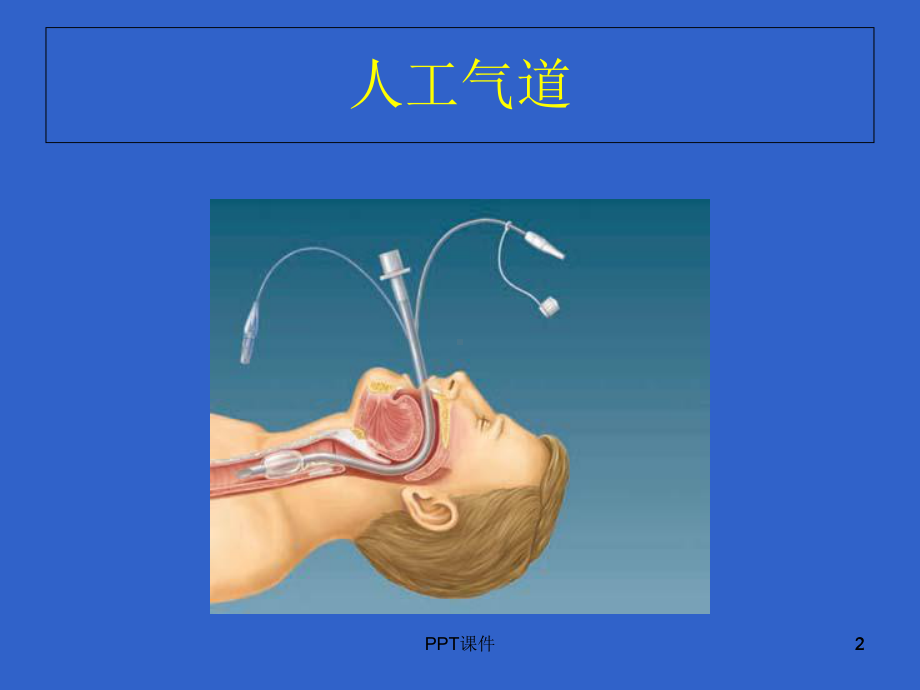 机械通气-课件.ppt_第2页