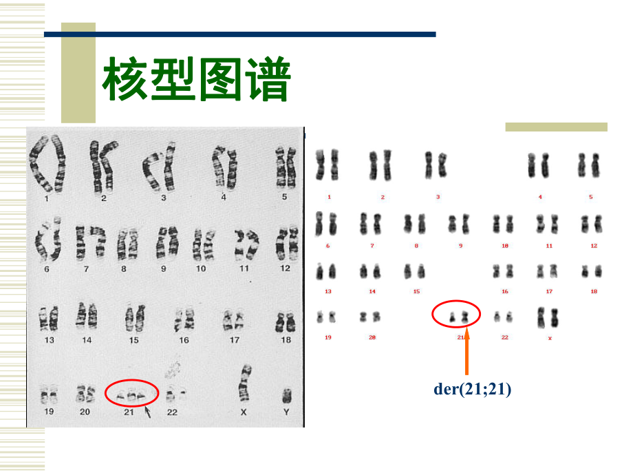 唐氏产前筛查-课件.ppt_第3页