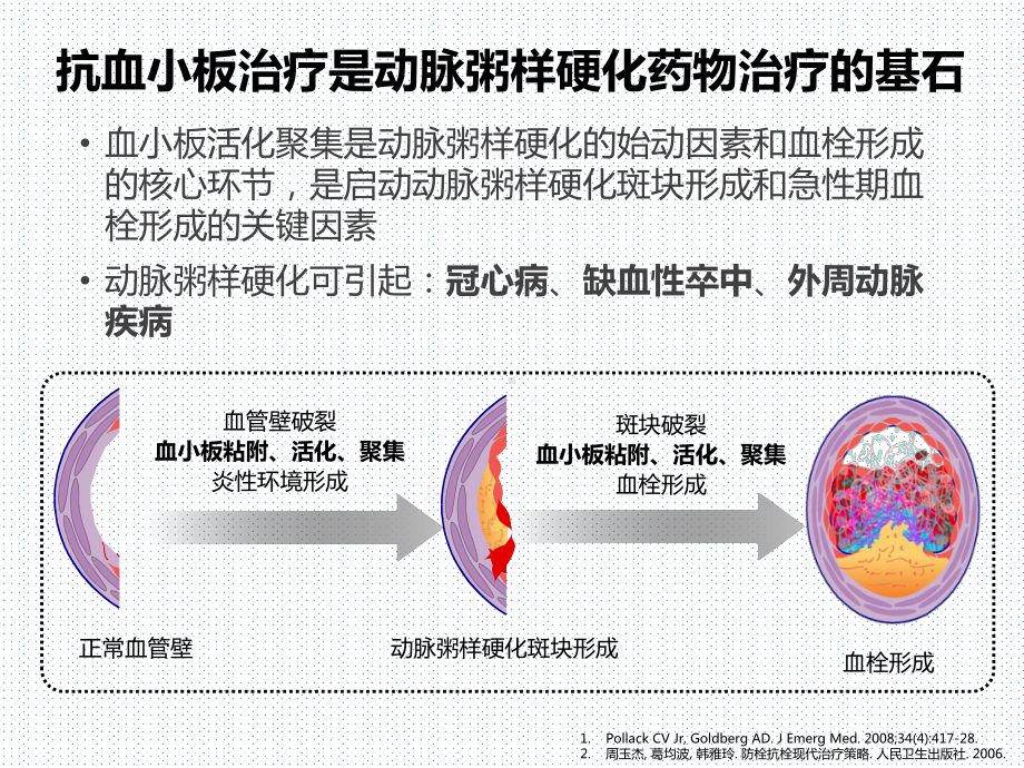 抗血小板药物(氯吡格雷)在社区卫生中心的应用课件.pptx_第2页