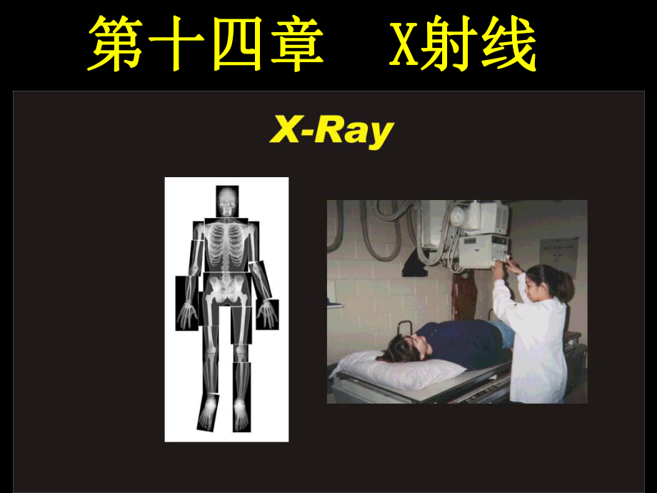 医用物理学第十四章-X射线课件.ppt_第1页