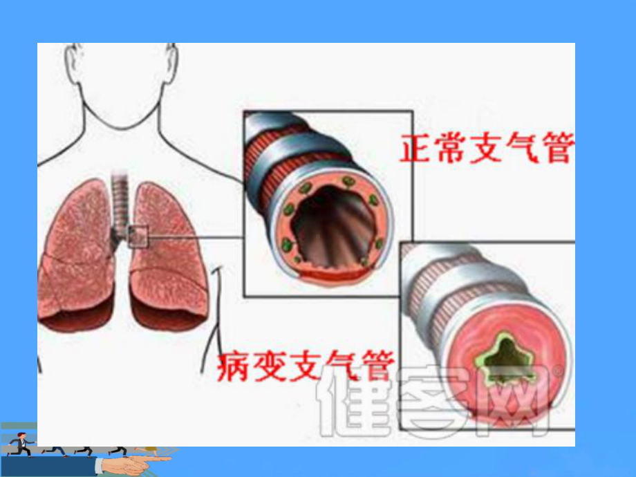 支气管扩张症护理查房资料课件.ppt_第3页