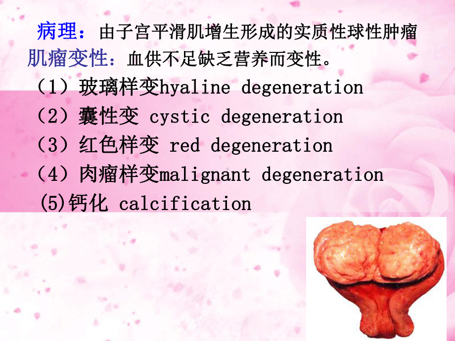 妇产科护理学(同名328)课件.ppt_第3页