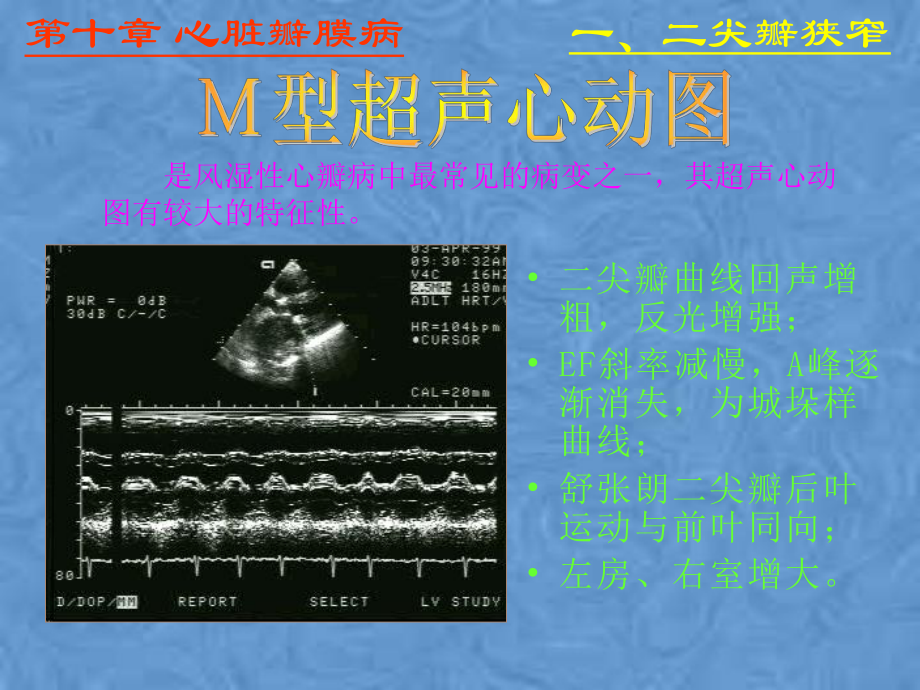 心脏彩超诊断课件.pptx_第2页