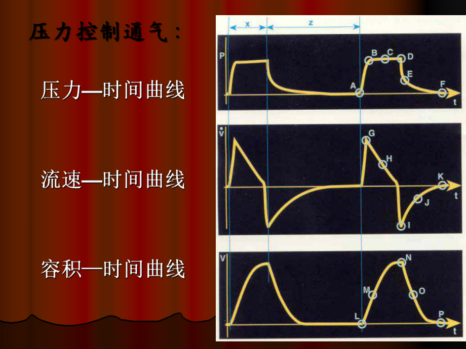 基础呼吸机波形分析解读课件.ppt_第3页